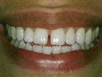 Konig Center for Cosmetic & Comprehensive Dentistry smile photos